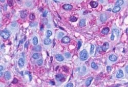 FPRL1/FPR2 Antibody, Novus Biologicals 50 &mu;g | Buy Online | Novus Biologicals | Fisher Scientific